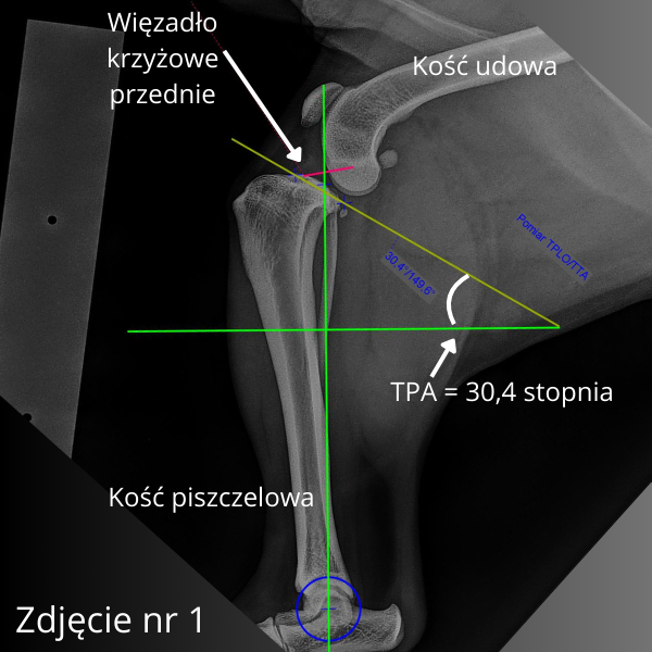 TPA